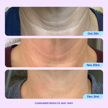 GoPure™ Anti-Wrinkle Cream
