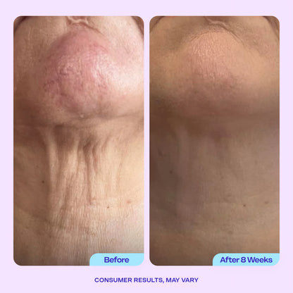 GoPure™ Anti-Wrinkle Cream