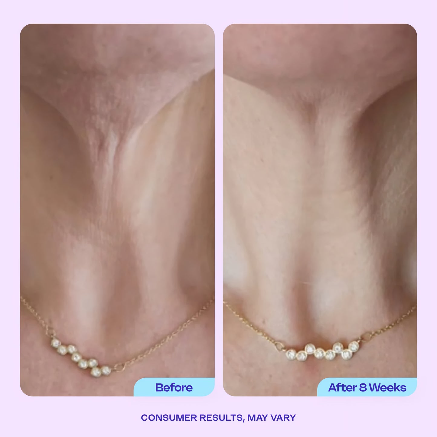 GoPure™ Anti-Wrinkle Cream